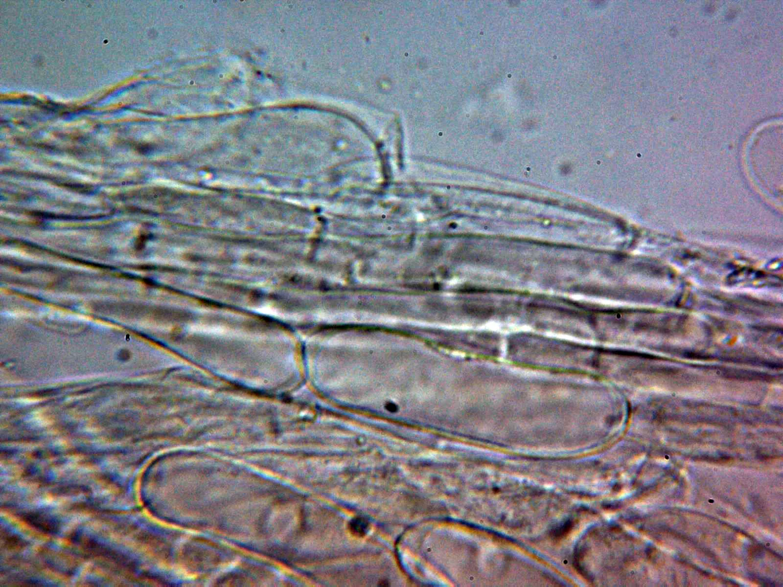 10 - Suprapellis agua 2